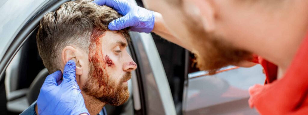 Indianapolis In facial injuries