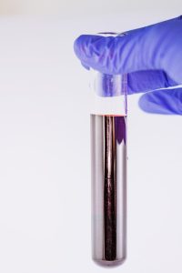 blood-test-ovarian-cancer