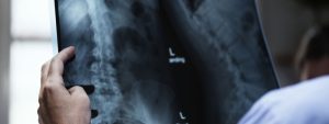 asbestos-exposure