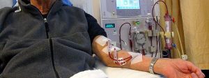 chronic-kidney-disease