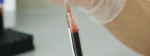 bloodwork