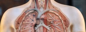 mesothelioma
