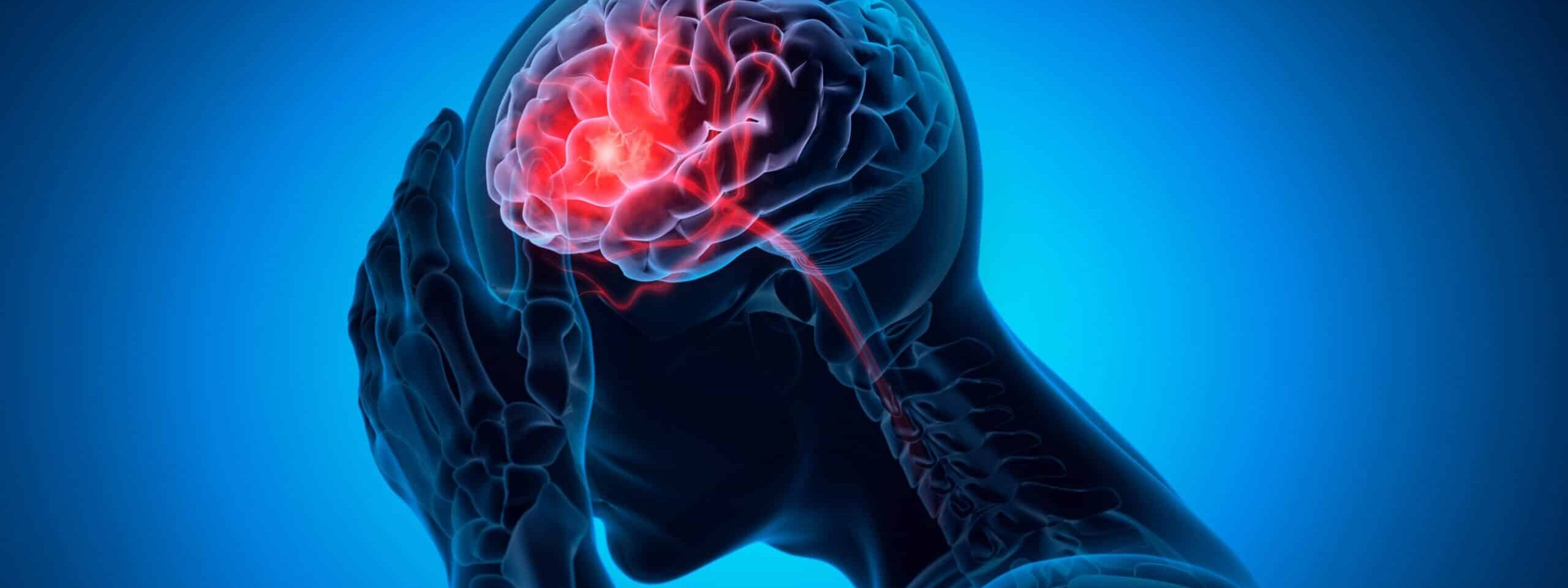 An Indiana traumatic brain injury somewhere on the TBI spectrum